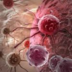 Cancer Immunotherapy and Natural Treatment – No chemo, No radiation, No Surgery, No Side effect